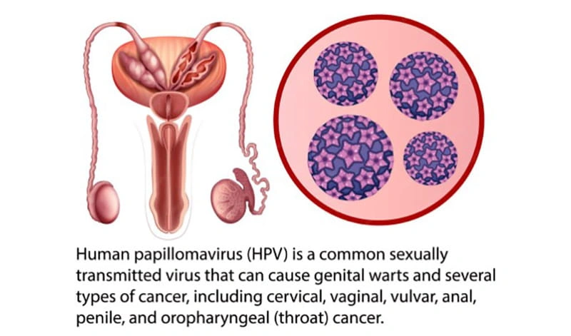 طول عمر ویروس زگیل تناسلی HPV داخل و خارج بدن چقدر است؟ | کلینیک برتر