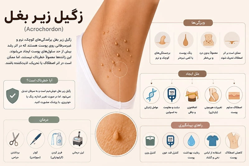 زگیل زیر بغل چیست و چرا به وجود می‌آید؟ | کلینیک برتر