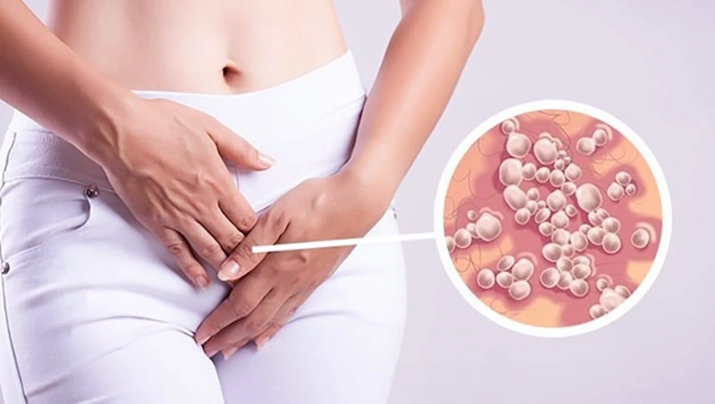 فرق زگیل تناسلی با تبخال تناسلی چیست؟
